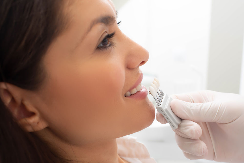How Dental Crowns are Valuable to Your Smile