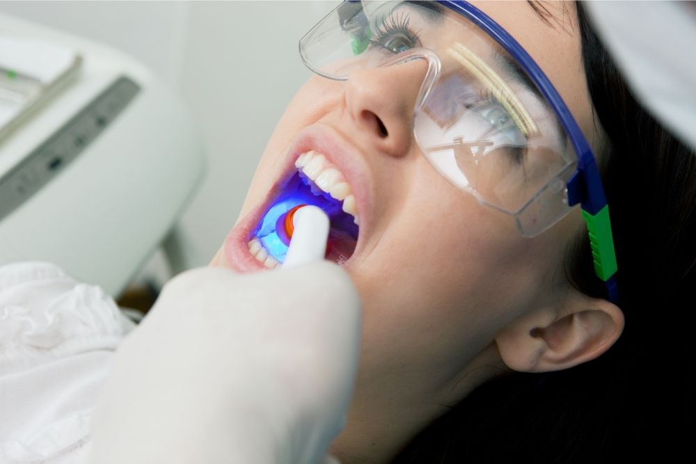 How Dental Fillings Can Help Treat Cavities