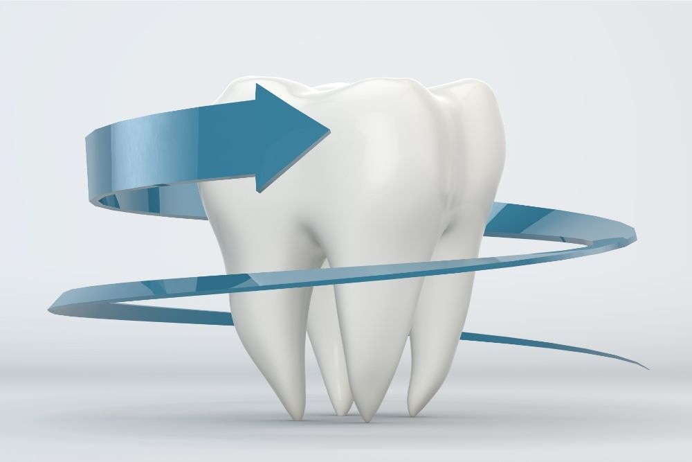 Managing a Chipped Tooth Emergency