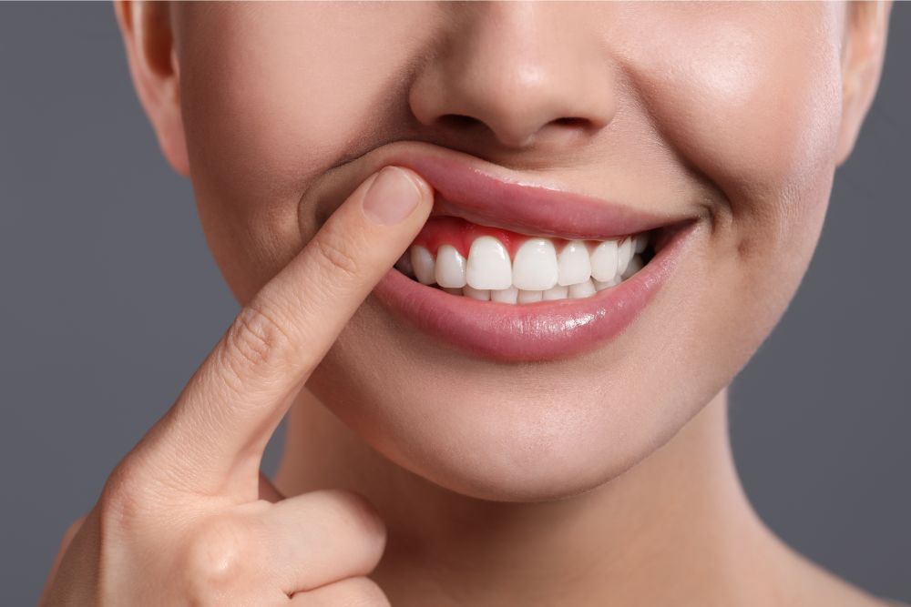 The Connection Between Cavities and Gum Disease